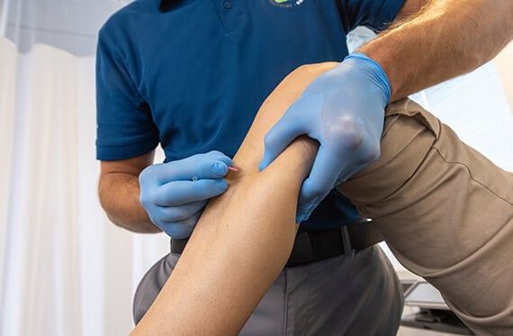Close up of a patient's shin as a therapist places a dry needle on the patient
